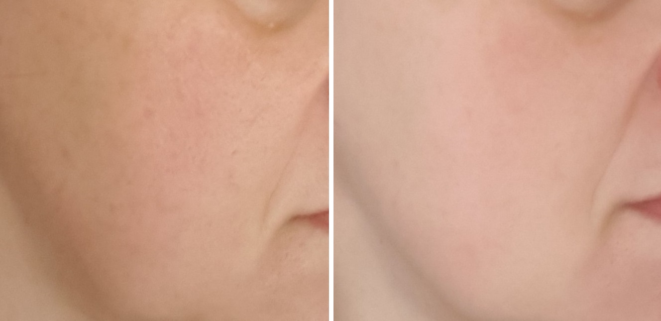 The Silk Crystal Total Lifting Mask Results